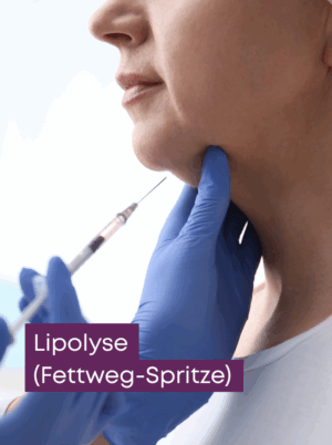 Lipolyse (Fettweg-Spritze)